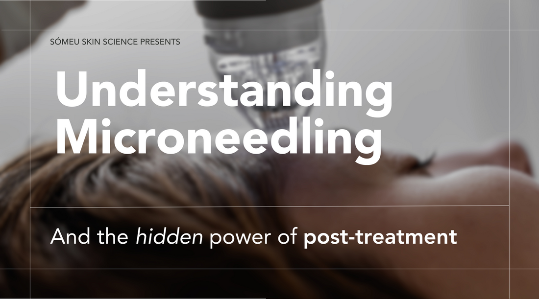 Understanding Microneedling and the Hidden Power of Post-Treatment Rebuild